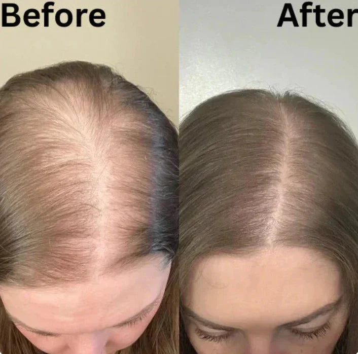 Organic Rosemary Hair Growth Shampoo Buy 2 Get 1 Free