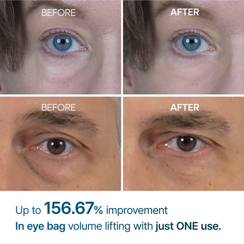 Eloria Eyephalt Eye Cream