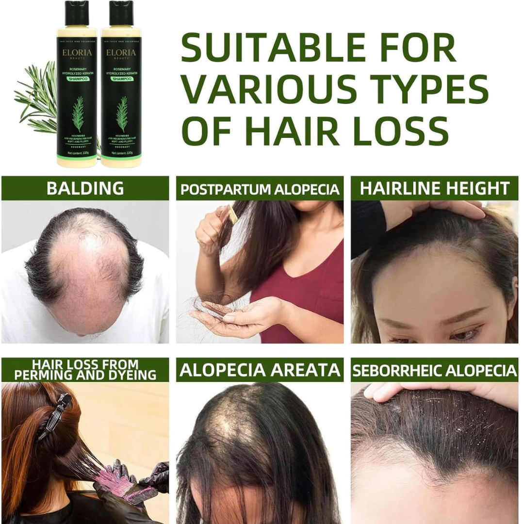 Organic Rosemary Hair Growth Shampoo