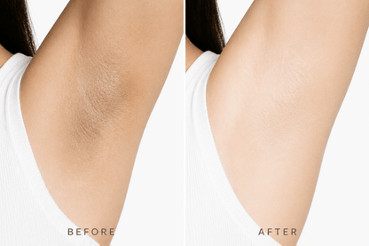 Eloria Kojic Acid & Turmeric Deodorant