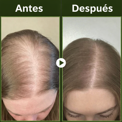 Champú orgánico de romero para el crecimiento del cabello