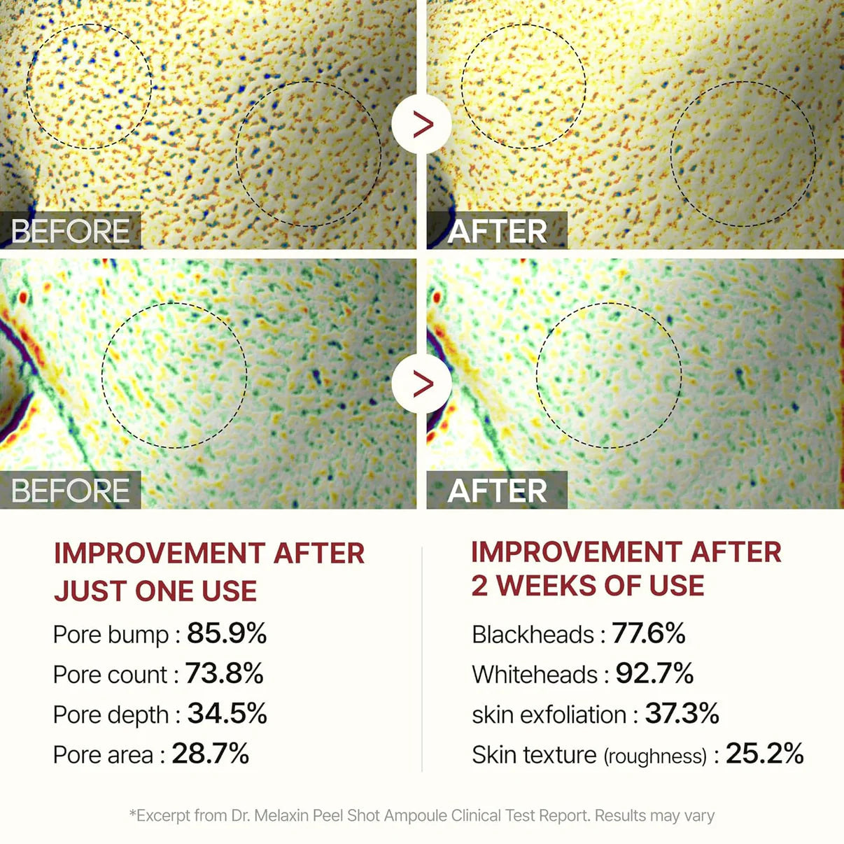 Eloria Sérum Ampolla de Arroz Peel™