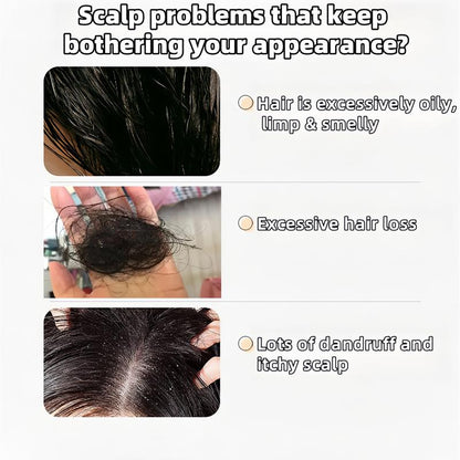 Anti Hair Fall